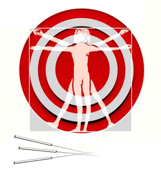 Acupuncture