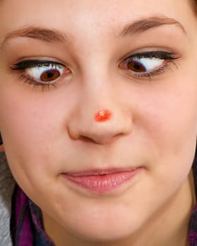 Big pimple on the nose