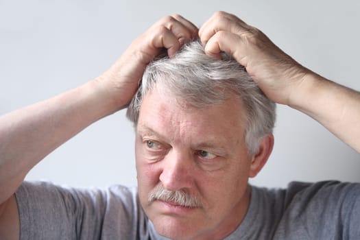 a mature man uses both hands to scratch his head