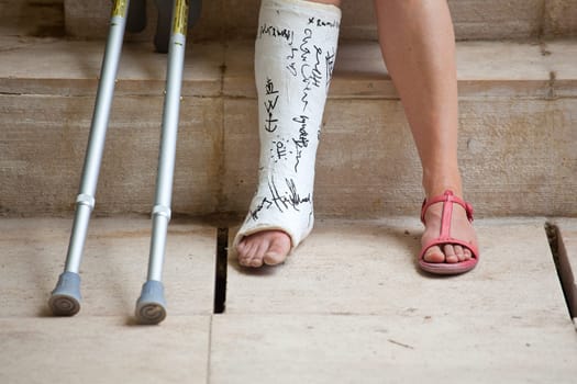 A Woman with leg in plaster and crutches
