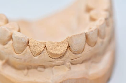 Teeth