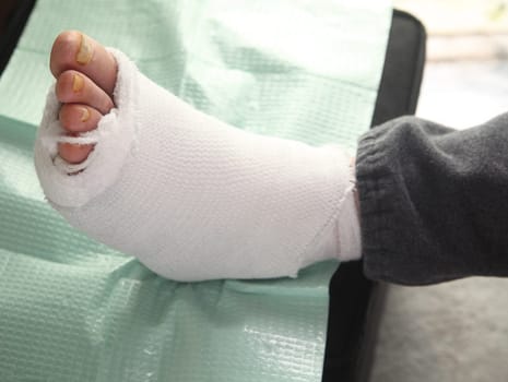 bandaged infected foot of a diabetic man
