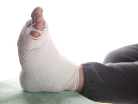 diabetic&#039 s infected foot bandaged