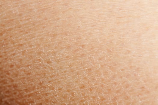 A macro detail background of dry skin