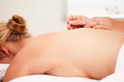Detail of a hand inserting an acupuncture nedle on the back Shu points