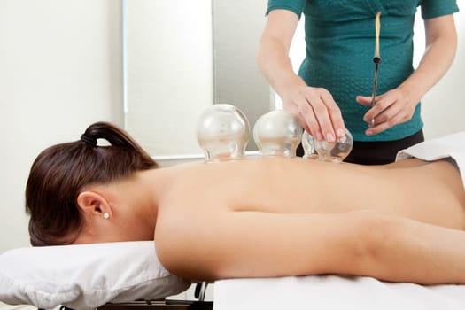 Acupuncture therapist placing a cup on the back of a female patient