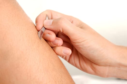 Choto acupuncture tool used on the leg of a young male