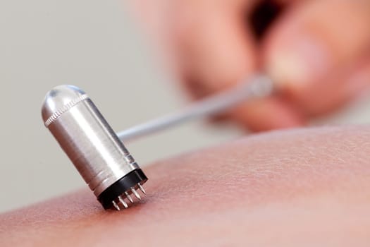 Macro detail of plum blossom acupuncture tool
