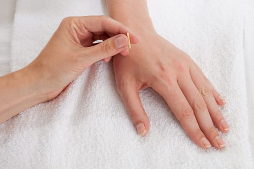 Detail of acupuncturist placing a needle in the Large Intestine 4 (LI4) point