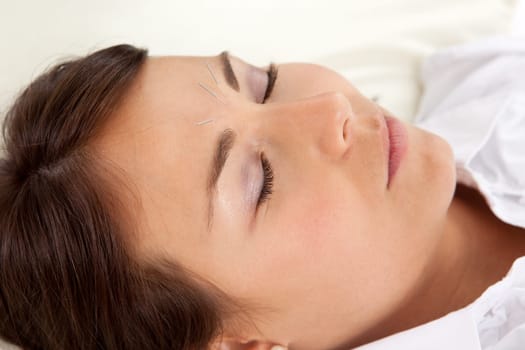 Detail of woman with acupuncture needles in face
