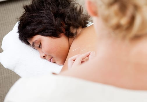 Young male with acupuncture needles in back
