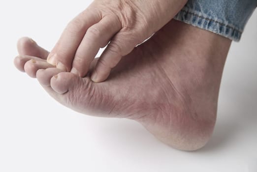 a man scratches his irritated toes