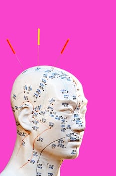 Acupuncture model