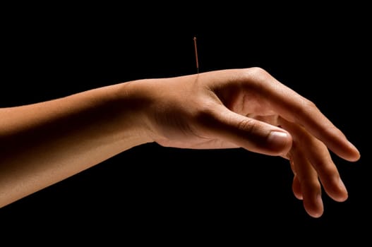 Woman getting an acupuncture treatment in a spa