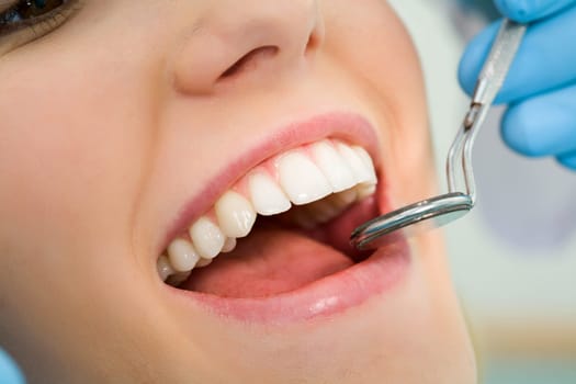 Close-up of patients open mouth before oral inspection with mirror near by