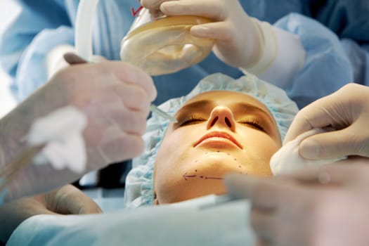 Close-up of patients chin with marks before operation