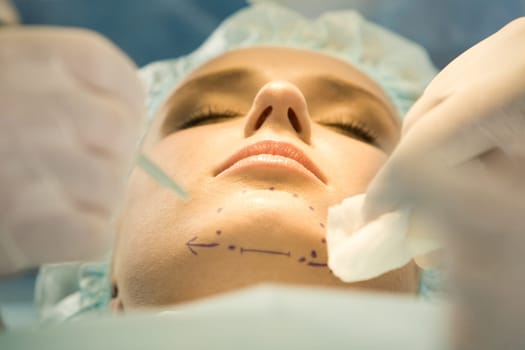Close-up of patients chin with marks before operation
