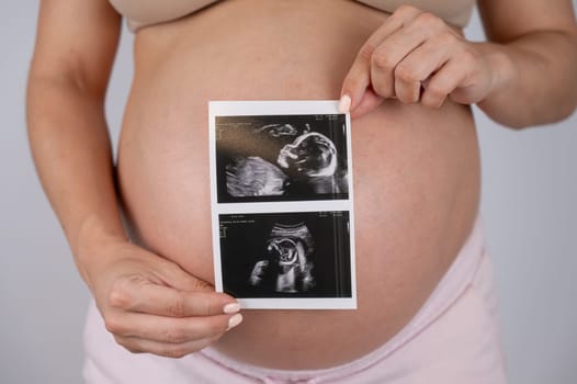 A pregnant woman holds a photo from an ultrasound screening against the background of a bare belly