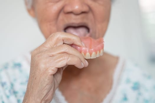 Asian elderly woman patient holding to use denture, healthy strong medical concept.