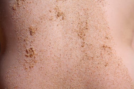 Sandy skin
