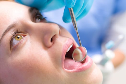 Dental mirror inside patient open mouth teeth reflection medical treatment