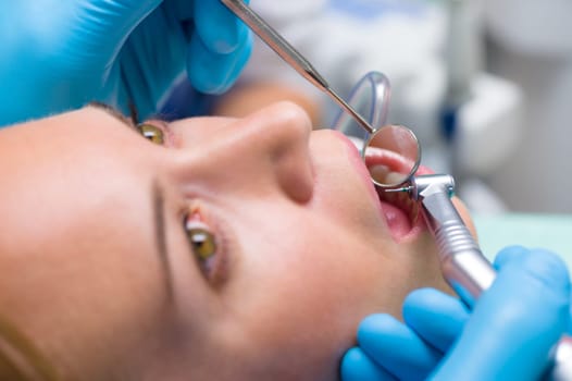 Dental treatment close-up female patient mouth with medical tools