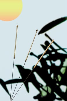 Acupuncture Needle