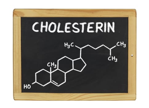 chemical structural formula of cholesterol on a slate
