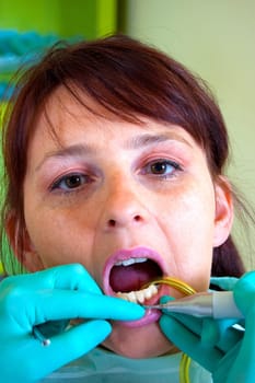 Dental treatment in a young woman in a dentist's office