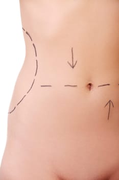 Woman belly marked out for cosmetic surgery. Isolated on white.