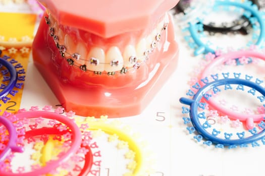 Orthodontic ligatures rings and ties, elastic rubber bands on orthodontic braces, model for dentist studying about dentistry.