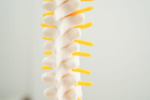 Spinal nerve and bone, Lumbar spine displaced herniated disc fragment, Model for treatment medical in the orthopedic department.