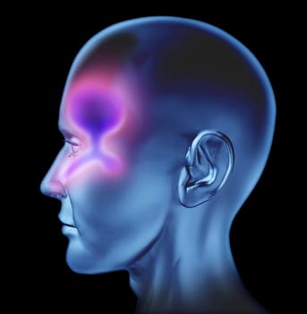 Human resperatory nasal congestion related to cold and bronchial flu coughing and influenze caused by the common cold virus that infects and builds green mucus in the nose throat and ear medical body system of drainage on a white background.