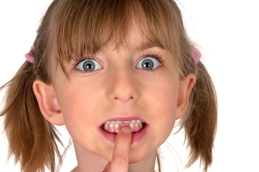 Girl shows gap between her teeth