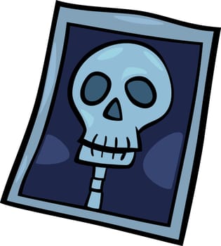 Cartoon Illustration of X-ray Photo of Human Head Clip Art
