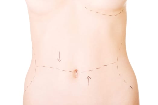 Woman belly marked out for cosmetic surgery. Isolated on white.