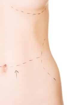Woman belly marked out for cosmetic surgery. Isolated on white.