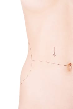 Woman belly marked out for cosmetic surgery. Isolated on white.