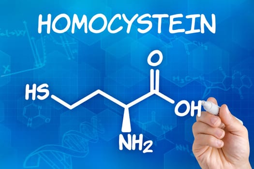 Hand draws chemical structural formula of homocysteine