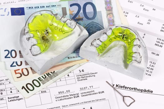 Cost plan braces,orthodontics