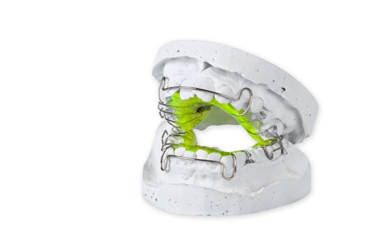 Plaster cast with loose braces