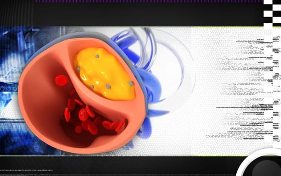 Digital illustration of Cogged arteries in colour background