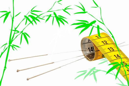 Acupuncture for weight loss
