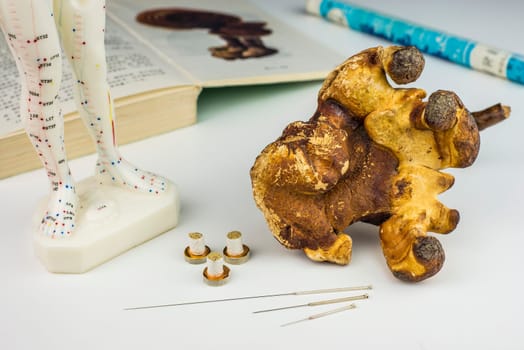Acupuncture needles,moxa cone,moxa cigar and reishi medicinal mushroom