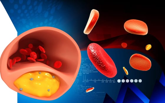 Digital illustration of Cogged arteries in colour background