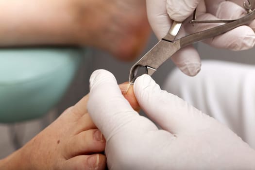 Cut toenails with pliers
