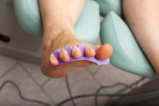 Foot with toe spreader before painting