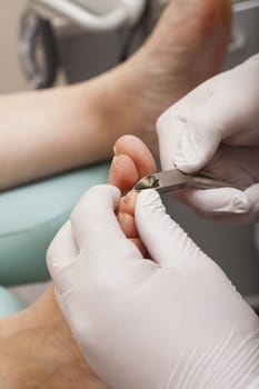 Cut the toe nails with pliers