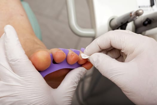 Foot care worker cleans toenails