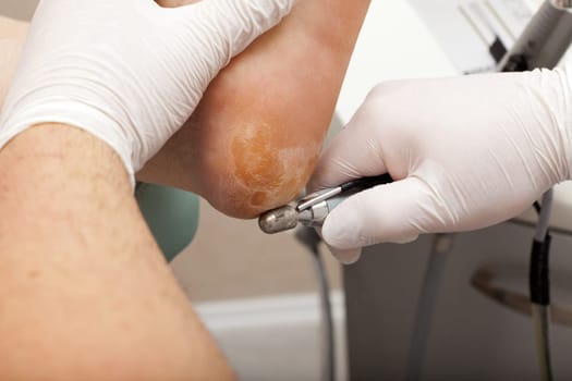 Foot care with grinding machine on work
